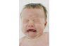 Un bébé souffrant de coliques apparaît en détresse et inconfortable.
